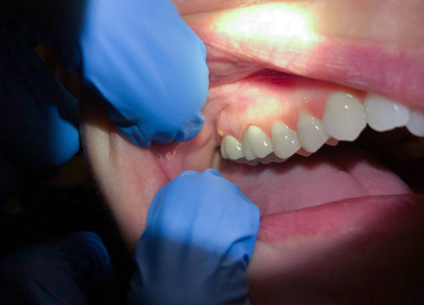 Best Emergency Tooth Extraction  in Old Greenwich, CT
