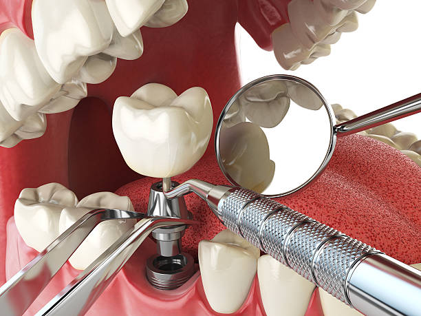 Best Broken Tooth Emergency  in Old Greenwich, CT